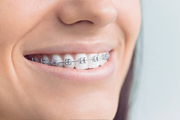 Why Choose Us for Your Dental Needs in Maplewood, MN